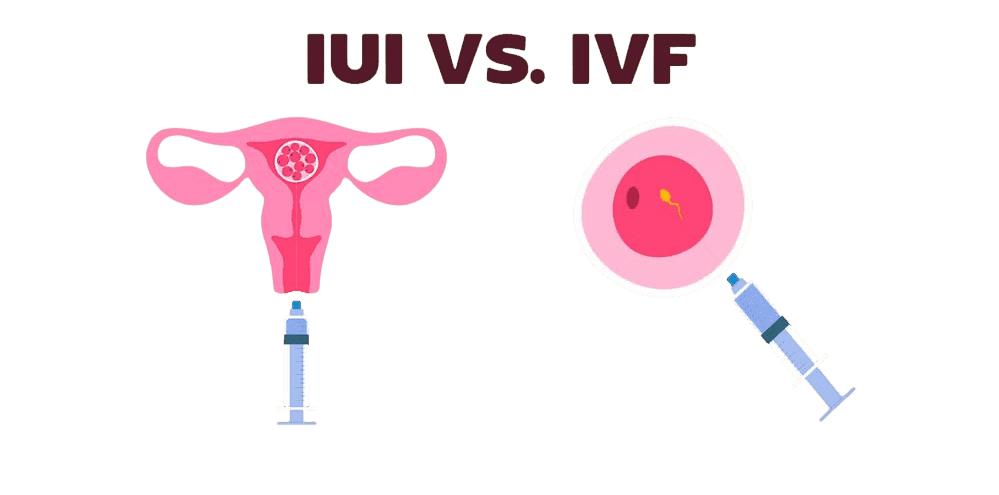 IUI or IVF: Which Fertility Treatment is Right for You?
