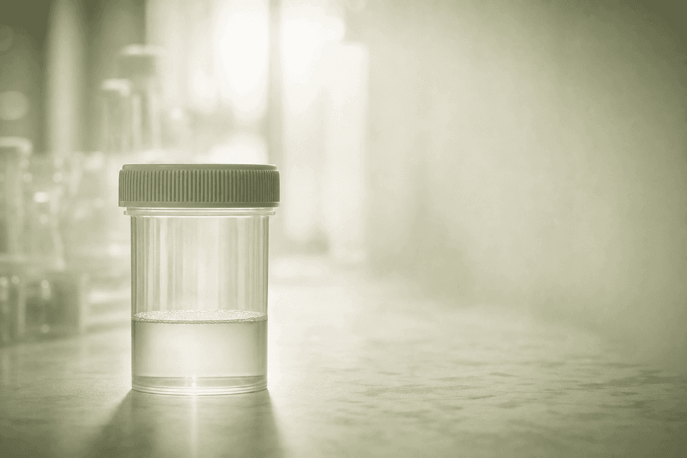 How Lifestyle Affects Male Fertility