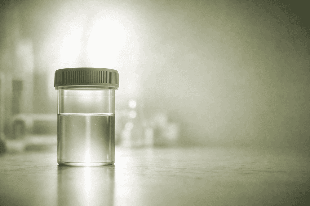 How to Prepare for a Semen Analysis: Abstinence, Collection and Timing