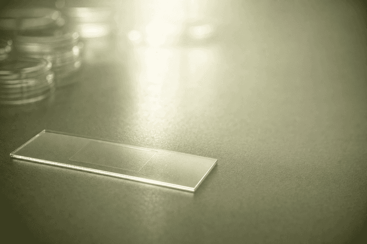 Role of Zinc in Sperm Health