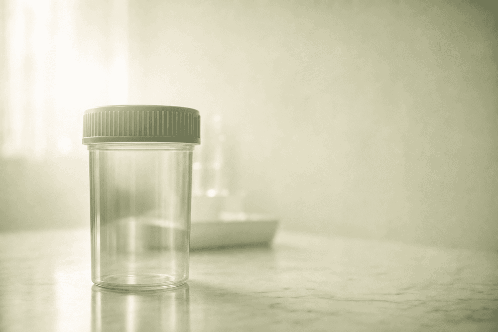 Semen Analysis: What It Reveals About Fertility
