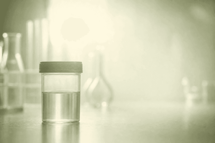 Understanding Azoospermia: Symptoms and Treatment